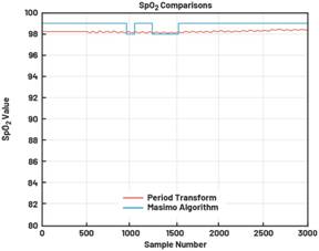 動(dòng)態(tài)離散周期變換技術(shù)突破：無(wú)ECG參考的生理信號(hào)精準(zhǔn)解析