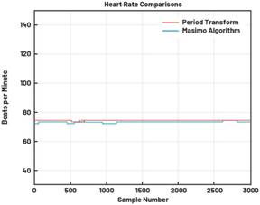 動(dòng)態(tài)離散周期變換技術(shù)突破：無(wú)ECG參考的生理信號(hào)精準(zhǔn)解析