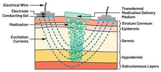 圖5.人體皮膚分層橫截面以及TMD和生物阻抗測量  考慮到生物阻抗分析的無創(chuàng)性，使用兩個金屬電極代表電氣傳感器，連接模擬前端(AFE)電路和患者皮膚。這個金屬與非金屬的接觸點是構(gòu)成整個電路的另一個關(guān)鍵部分，連接了AFE和人體電氣模型。電荷載體（電極中的電子和人體內(nèi)的離子）之間的相互作用可能對這些傳感器的性能產(chǎn)生重大影響，需要根據(jù)每種應(yīng)用進(jìn)行具體考慮。首先，金屬與離子溶液接觸的相互作用導(dǎo)致金屬表面附近溶液中離子濃度的局部變化。這種現(xiàn)象會改變電極下方區(qū)域的電荷中性，導(dǎo)致金屬周圍的電解質(zhì)電位與溶液其余部分不同，從而在金屬和電解質(zhì)主體之間產(chǎn)生一個電位差，即常說的“半電池電位”。其次，注入電流的直流分量會導(dǎo)致電極極化。  表1.各種電極類型和相應(yīng)的半電池電位  金屬及反應(yīng)  半電池電位(V)  Al → Al3+ + 3e- Al → Al3+ + 3e-  –1.706 –1.706  Ni → Ni2+ + 2e- Ni → Ni2+ + 2e-  –0.230 -0.230  H2 → 2H+ + 2e- H2 → 2H+ + 2e-  0.000 (by definition) 0.000（根據(jù)定義）  Ag + Cl- → AgCl + e- Ag + Cl- → AgCl + e-  +0.223 +0.223  Ag → Ag+ + e- Ag → Ag+ + e-  +0.799 +0.799  Au → Au+ + e- Au → Au+ + e-  +1.680 +1.680  這是一種不良現(xiàn)象，往往導(dǎo)致電極性能下降。這些考量表明，電極也需要定義適當(dāng)?shù)碾姎饽Ｐ停▍⒁妶D6）。我們可以將干電極表示為具有三個串聯(lián)元件的電路：一個用于模擬半電池電位(EHC)的直流電源；一個用于模擬金屬和非金屬（人體）之間接觸的RC并聯(lián)電池(Rd||Cd)；以及一個用于模擬電極金屬的電阻Rs。