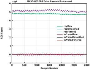 動(dòng)態(tài)離散周期變換技術(shù)突破：無(wú)ECG參考的生理信號(hào)精準(zhǔn)解析
